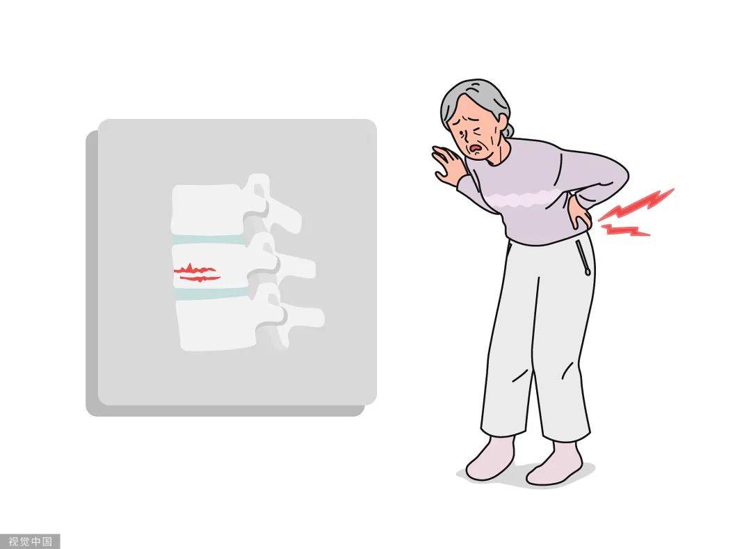 图片[1]-感觉自己变矮了？别大意，可能是骨骼在发出警报！-同舟