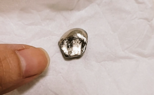 「蕎麦食べに行ったら銀歯が出てきた。俺のかな?歯医者行って治してもらおっと」 → 歯医者からヤバすぎることを言われて絶句・・・-同舟