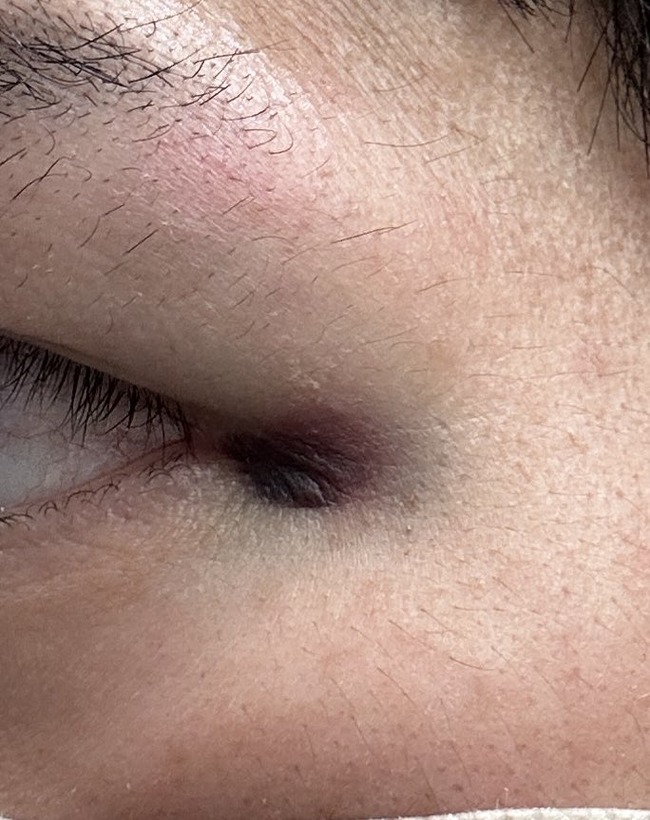 图片[3]-ドルオタさん、あまりにも凶暴すぎる　整理番号1番チケを持っていた人に殴りかかり怪我をさせる→結果・・・-同舟