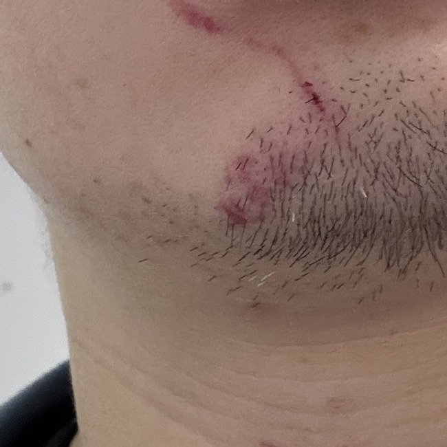 图片[4]-ドルオタさん、あまりにも凶暴すぎる　整理番号1番チケを持っていた人に殴りかかり怪我をさせる→結果・・・-同舟