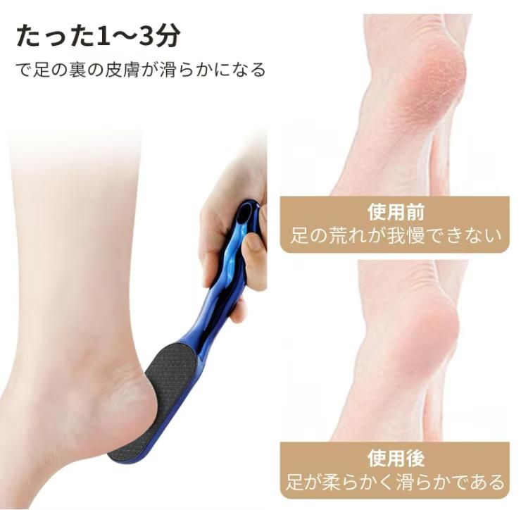 图片[3]-去角质工具两件套
40元包邮-日本亚马逊论坛-海外推广-同舟