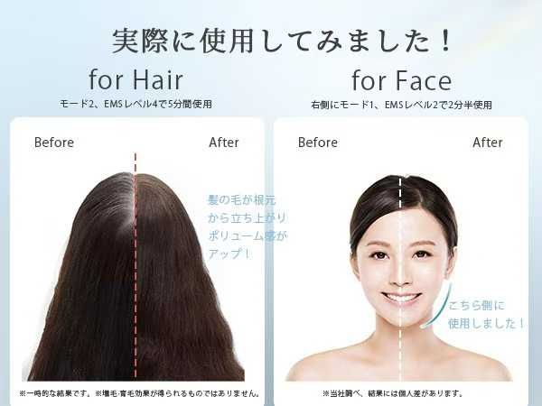 图片[3]-超级推荐！自然评分特别高头皮按摩面部提升身体按摩一机多用-日本亚马逊论坛-海外推广-同舟