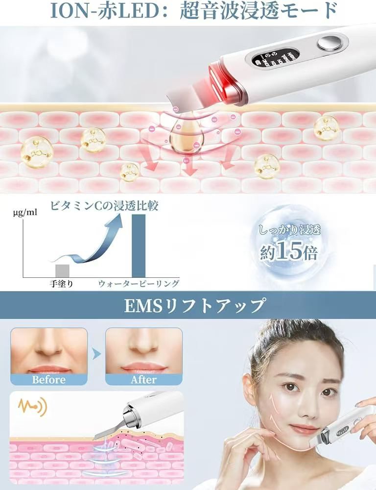 图片[4]-美容仪铲皮机海外仓到货快特便宜-日本亚马逊论坛-海外推广-同舟