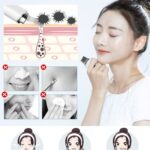 美容仪铲皮机海外仓到货快特便宜-同舟